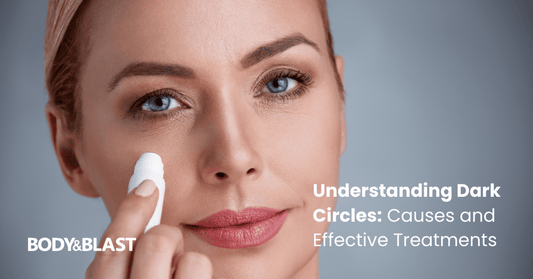 What Causes Dark Circles Under Your Eyes and How to Treat Them?